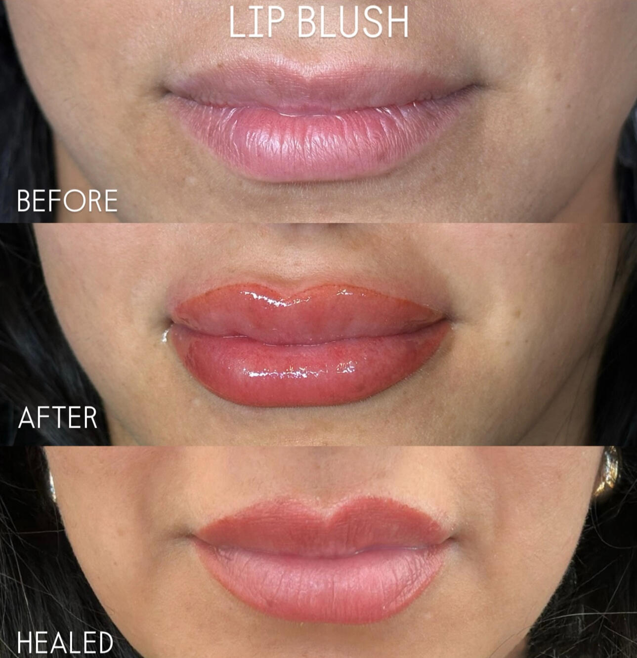 Lip blush results