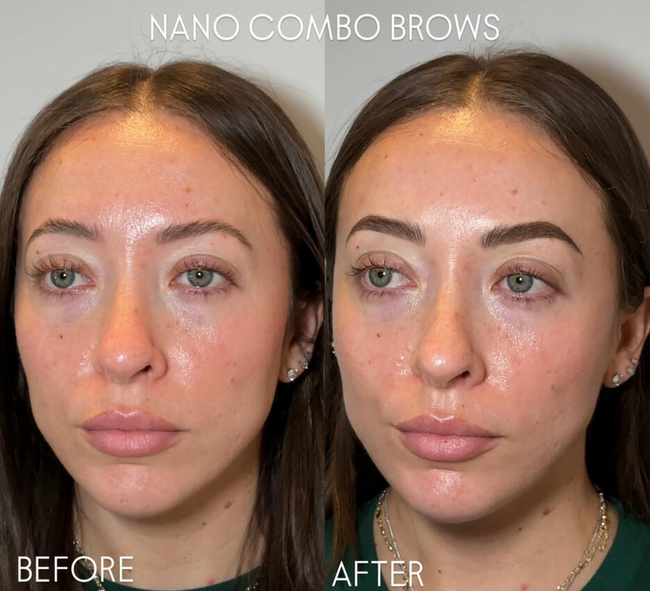 Nano combo brows Nano combo brows